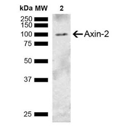 Axin-2 Antibody, Novus Biologicals 100 &mu;g | Buy Online | Novus Biologicals | Fisher Scientific
